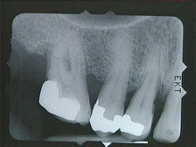radiograph image