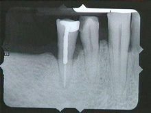 radiograph image