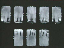 radiograph image