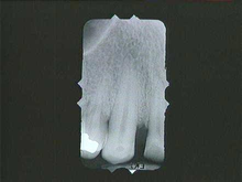 radiograph image