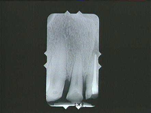 radiograph image