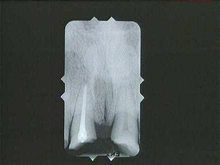 radiograph image