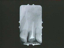 radiograph image