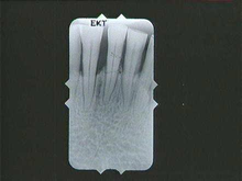 radiograph image