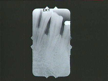 radiograph image