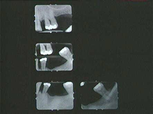 radiograph image
