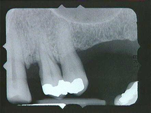 radiograph image