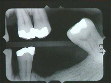 radiograph image