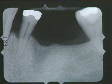 radiograph image