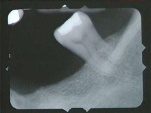 radiograph image
