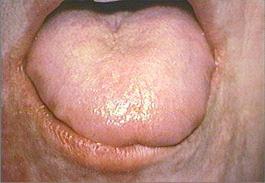 close-up of face and tongue close-up of face and tongue