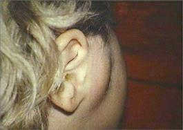 posterior-lateral view of patient and swelling