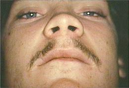 nose and south